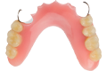 acrylic partial denture